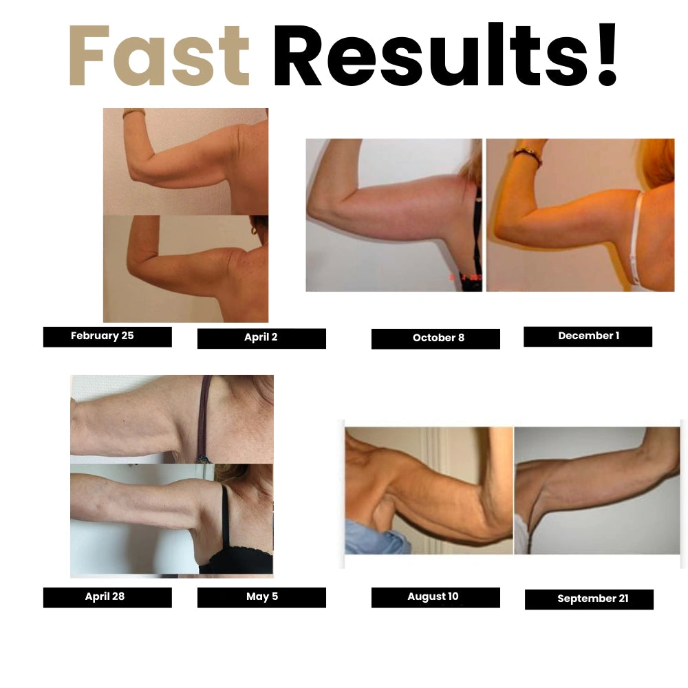 SlimCore 3D Sculpting Sleeves - No more flabby arms